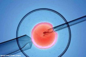 有偿同志供卵咨询怎么找